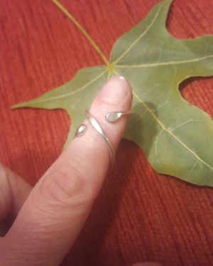 silver ring splint