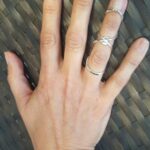 Silver ring splint