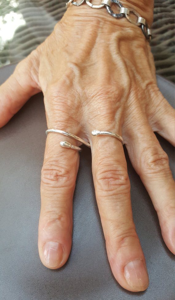 ring splints for arthritis