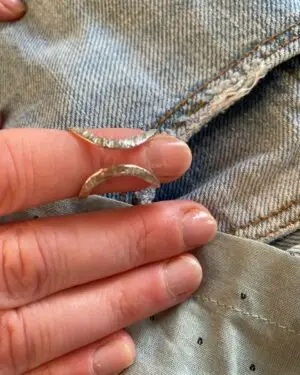 ring splints for arthritis fingers