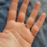 ring splints for arthritis fingers