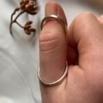 Silver ring splint