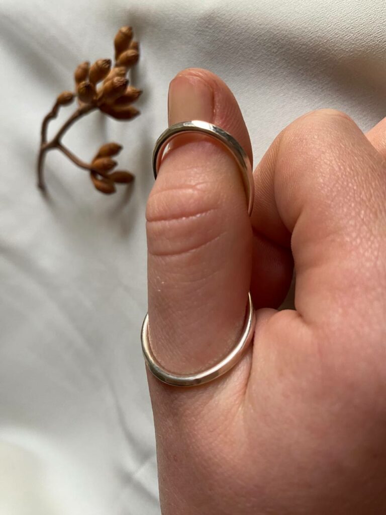 Silver ring splint