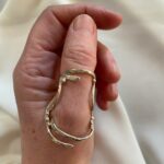 silver ring splint