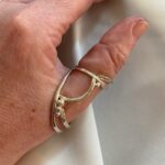 silver ring splint