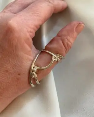 silver ring splint