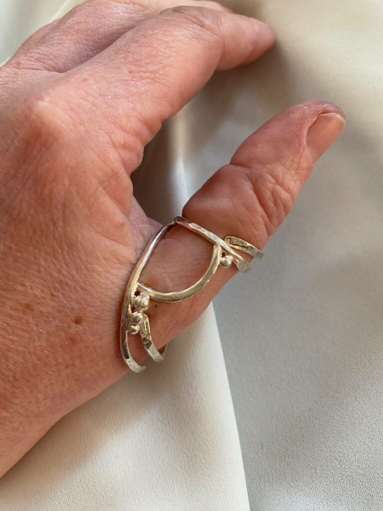 silver ring splint