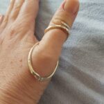 silver ring splint