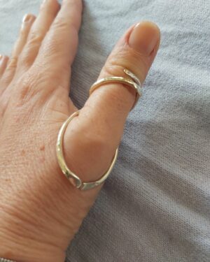 silver ring splint