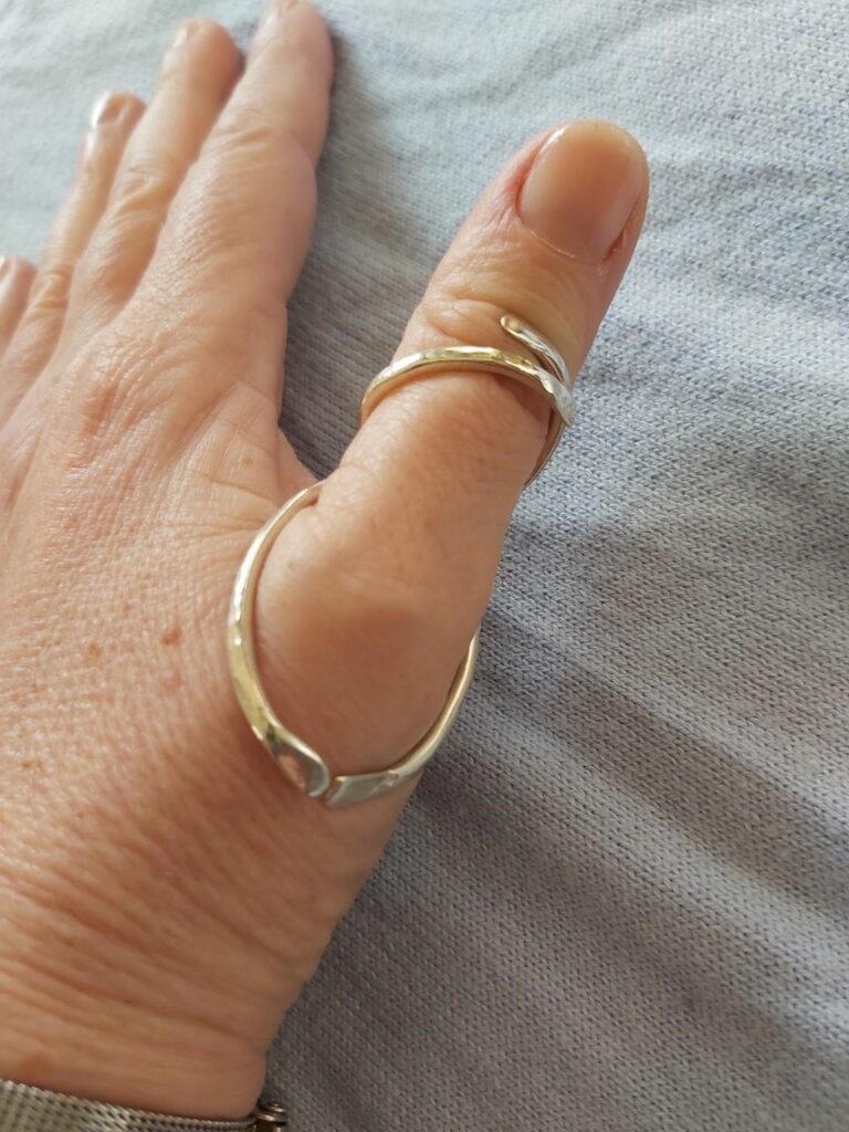 silver ring splint