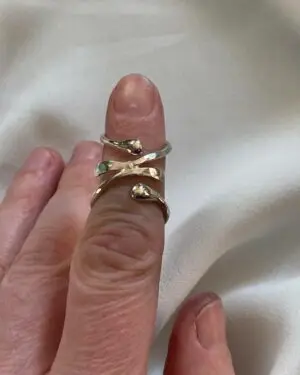silver ring splint
