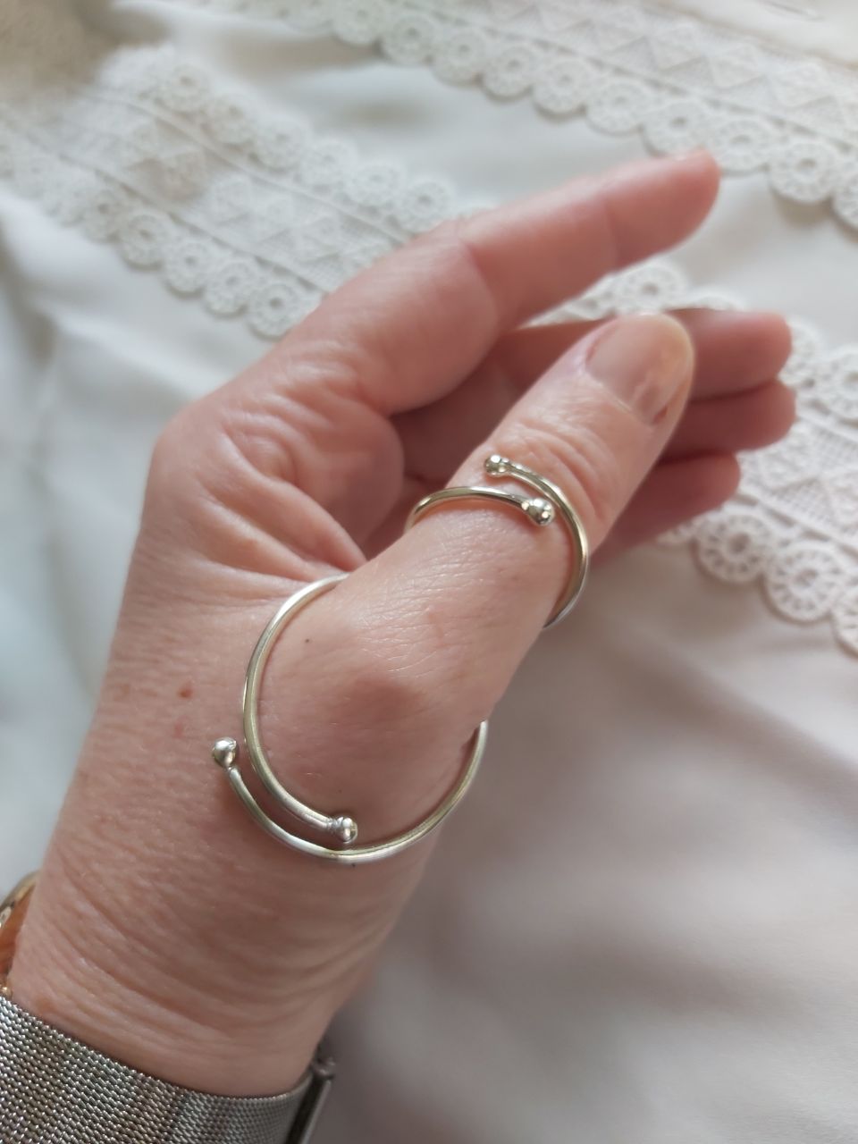 silver ring splint