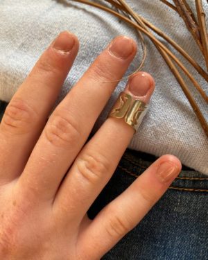 silver ring splint, Arthritis Joints Splints