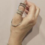 silver ring splint