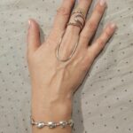 silver ring splint