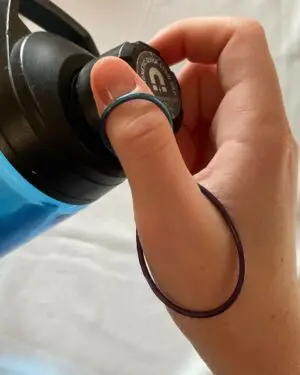 silver ring splints