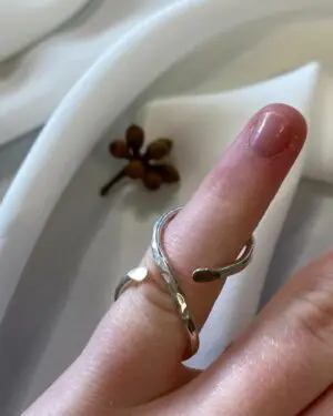 silver ring splint, trigger thumb