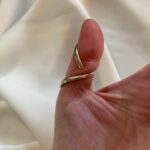 silver ring splint