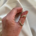 silver ring splint Swan Neck Deformity Splints