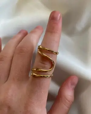 silver ring splint, trigger thumb