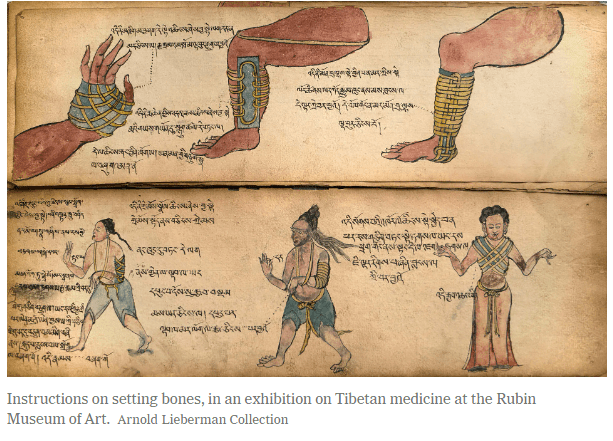 History of Splinting