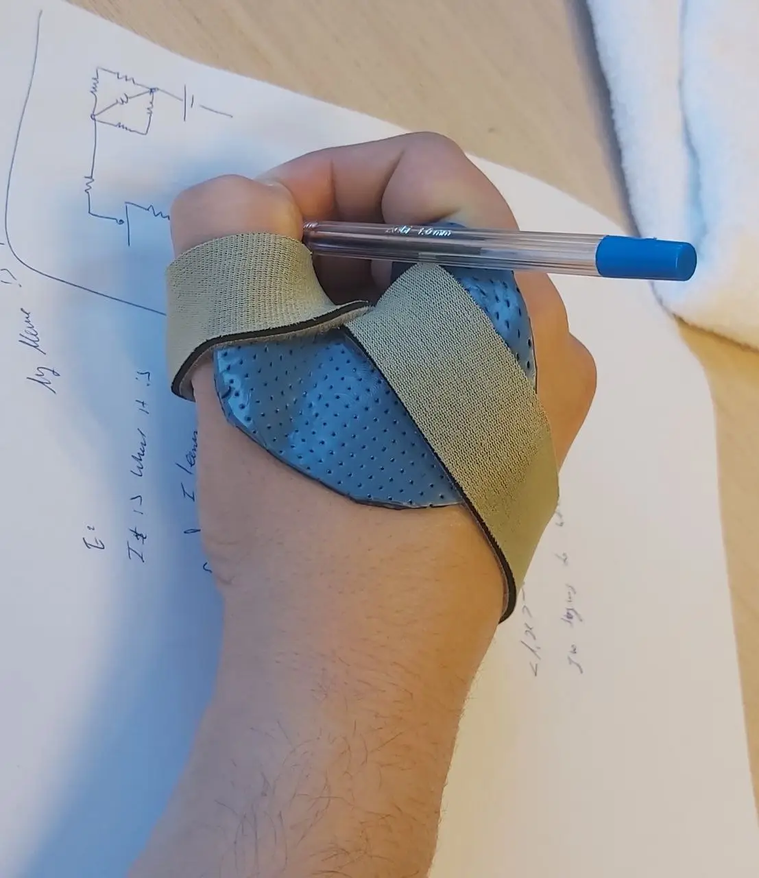 סד תפקודי לכתיבה במסגרת שיקום כף יד במודיעין